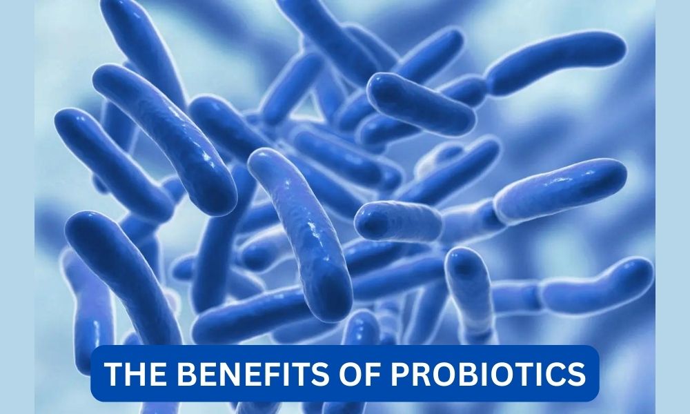 What are the benefits of probiotics